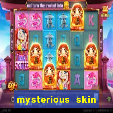 mysterious skin online dublado